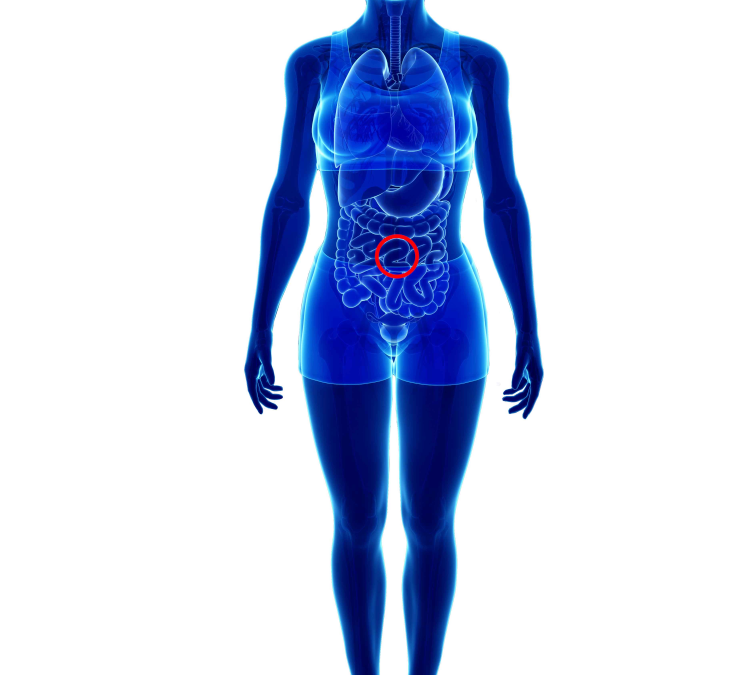 Containment netting support for hernia