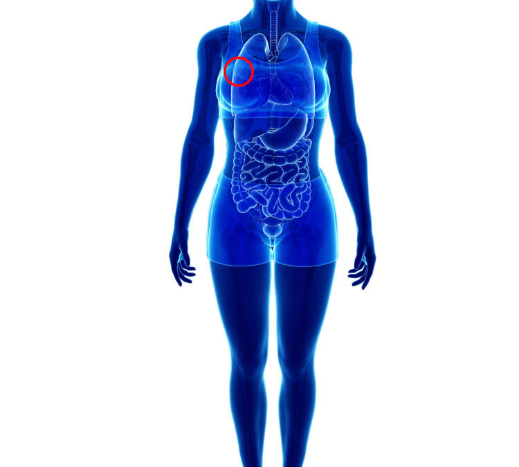 Blood filtration fabrics